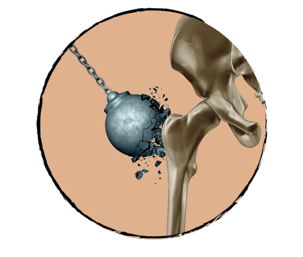 Arthrite: les Huiles Essentielles à utiliser - Olyaris